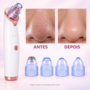 Antes e depois aprimorado do removedor de cravos