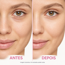Comparativo de antes e depois aprimorado