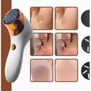 Lixador De Pé Elétrico/Removedor Esfoliador Elétrico Para Pés Lixa Elimina Calos